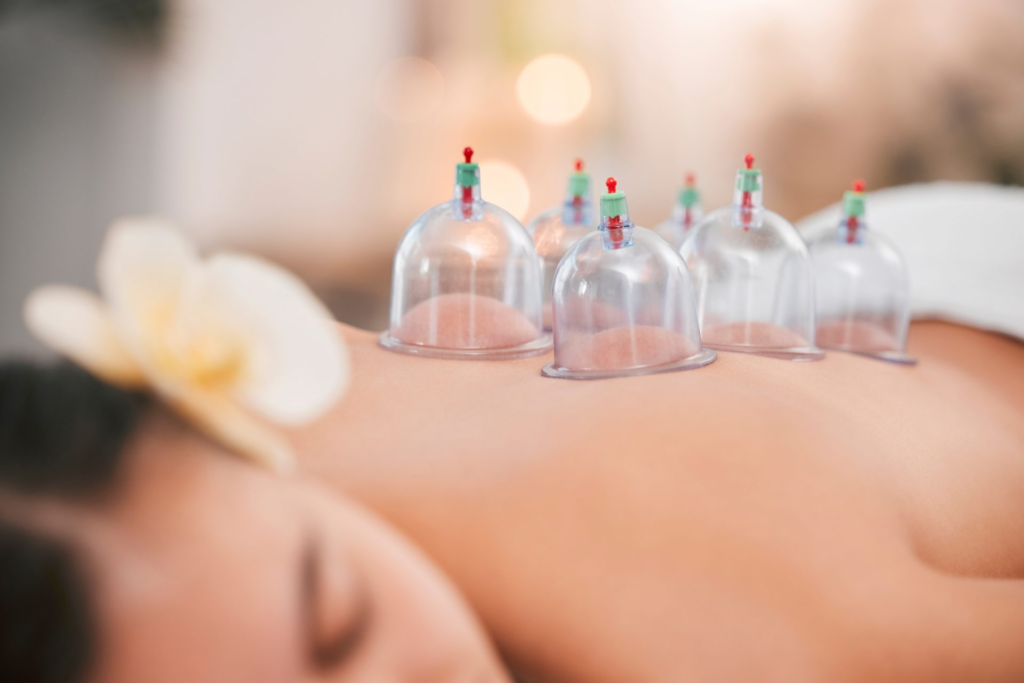 cupping therapy resized